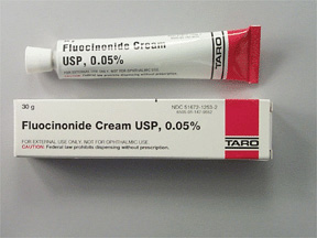 Fluocinonide