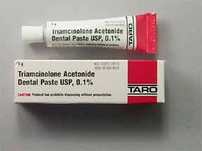 Triamcinolone Acetonide