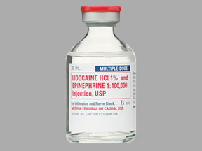 Lidocaine-epinephrine